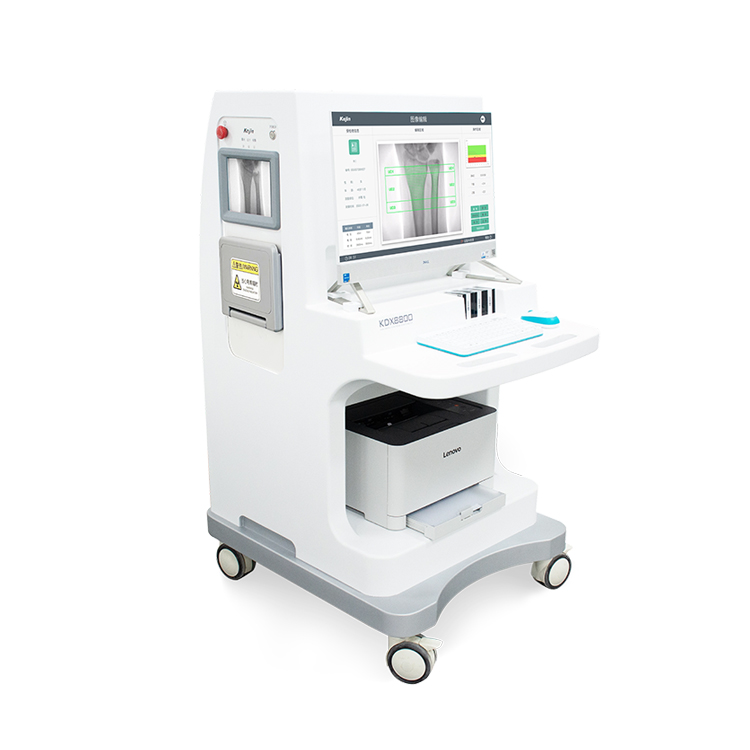 科進Kejin 雙能X射線骨密度儀KDX8000+ 側(cè)屏顯示